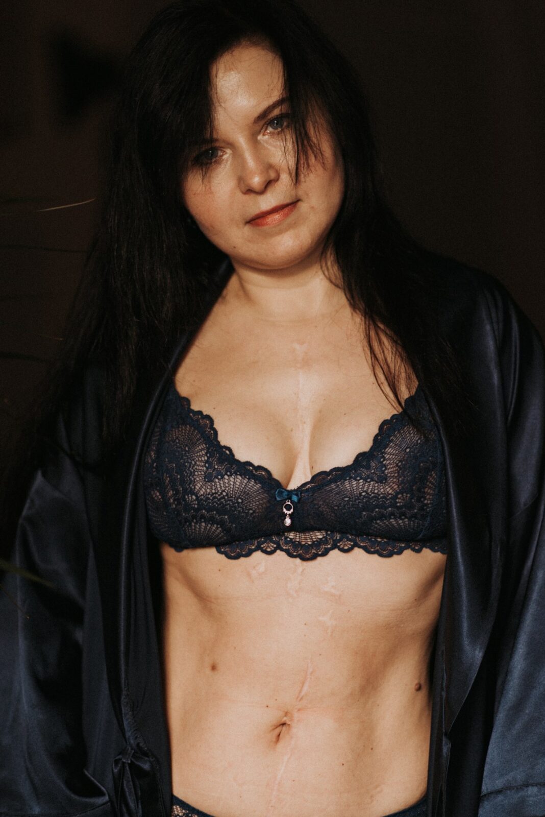 Полюби свої шрами