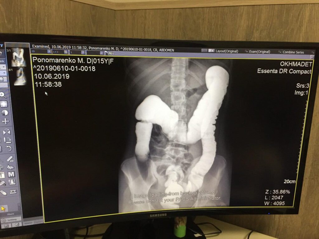 Безбар’єрність та чому через її відсутність я не маю спогадів про школу?